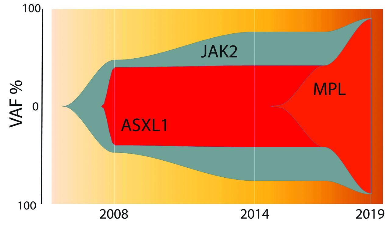 Clinical Acceleration Of Jak2 P V617f Driven Myeloproliferative Disease Due To A New Uncommon Homozygous Mpl P Y591d Mutation Haematologica