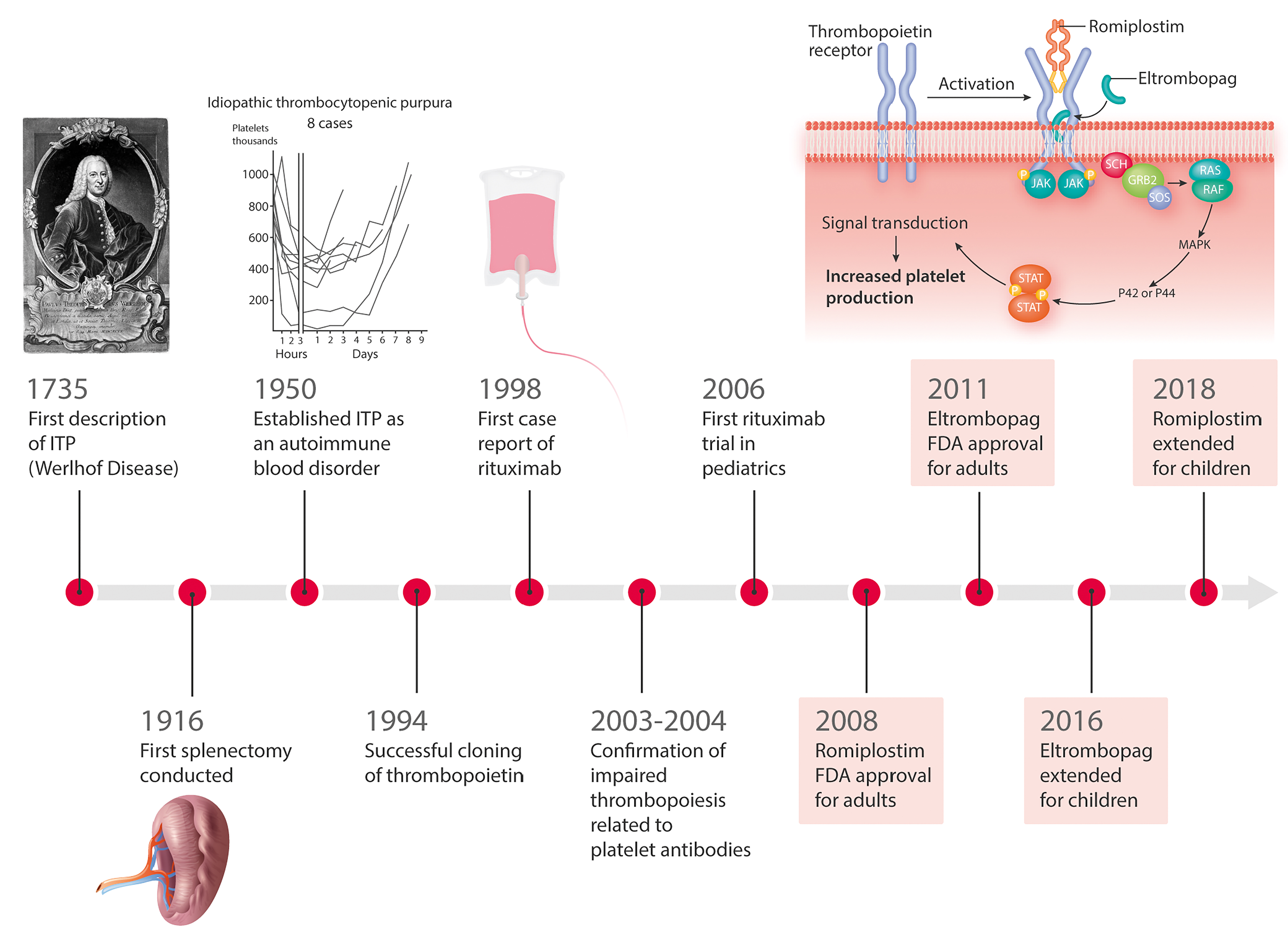 idiopathic thrombocytopenic purpura diagram