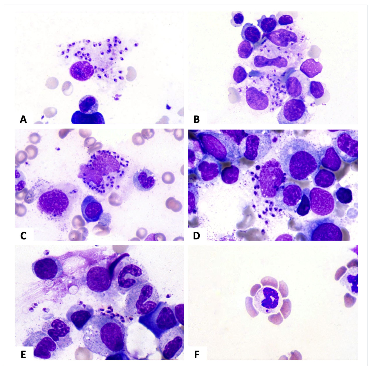 visseral leishmaniasis histolojisi