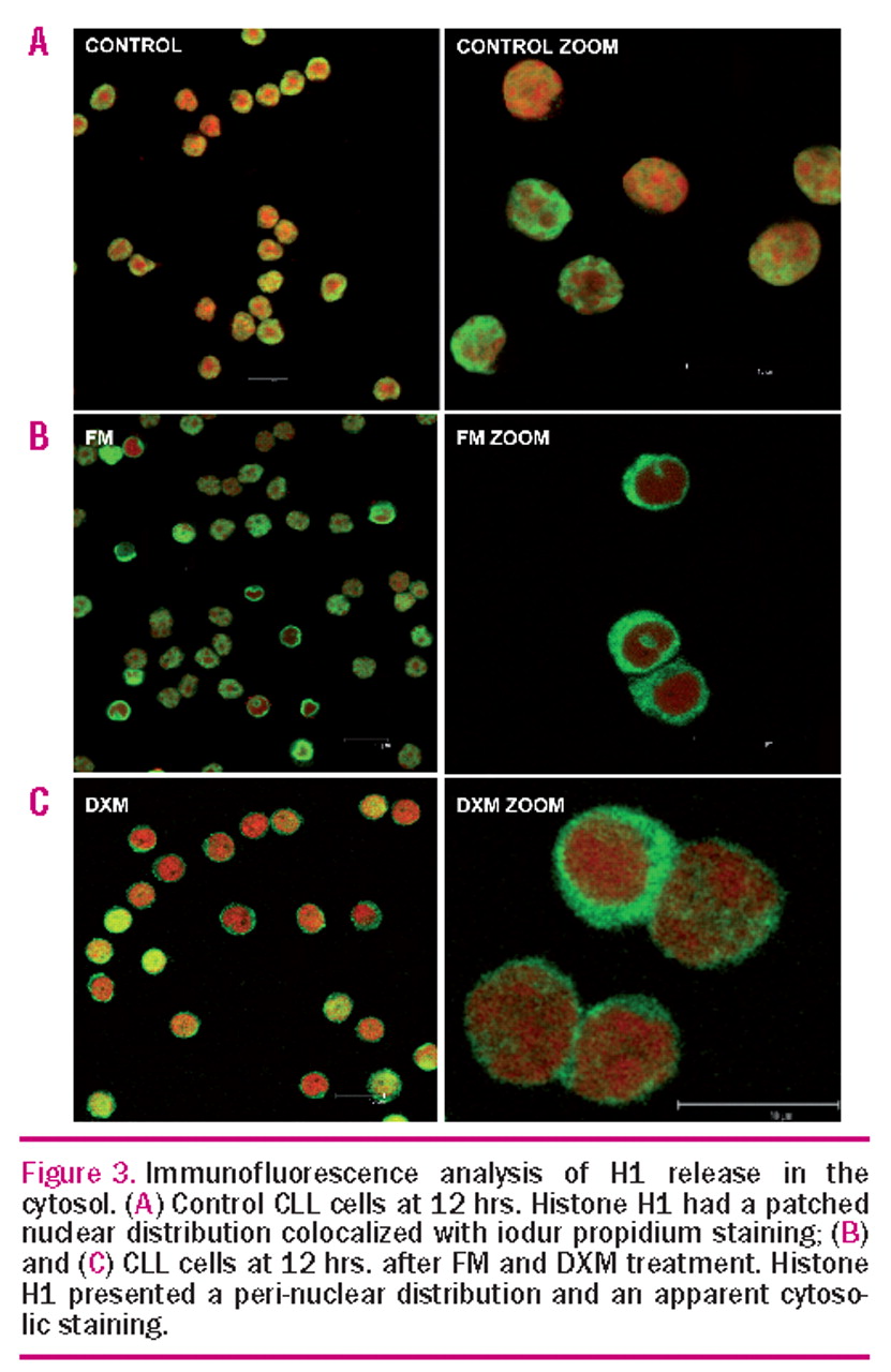 histones h1