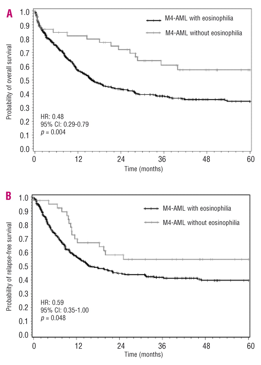 M4 acute myeloid leukemia the role of eosinophilia and in