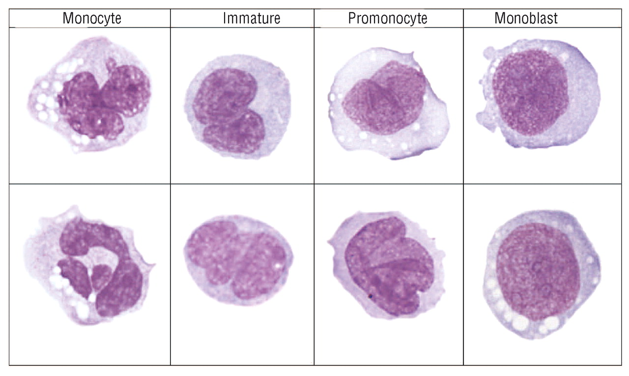 Morphological evaluation monocytes and their precursors |