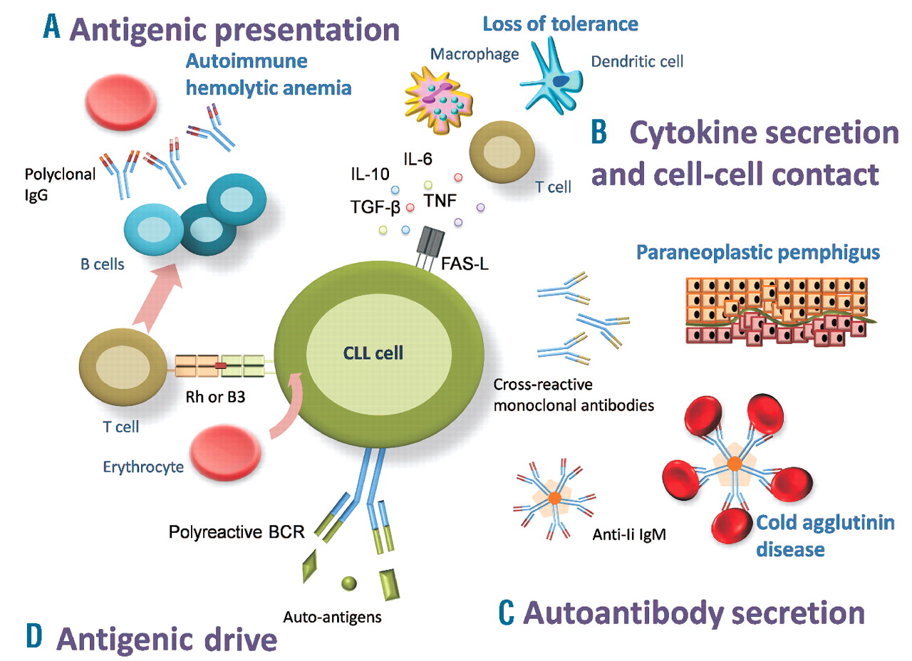 Pathogenesis Of Chronic Lymphocytic Leukemia 