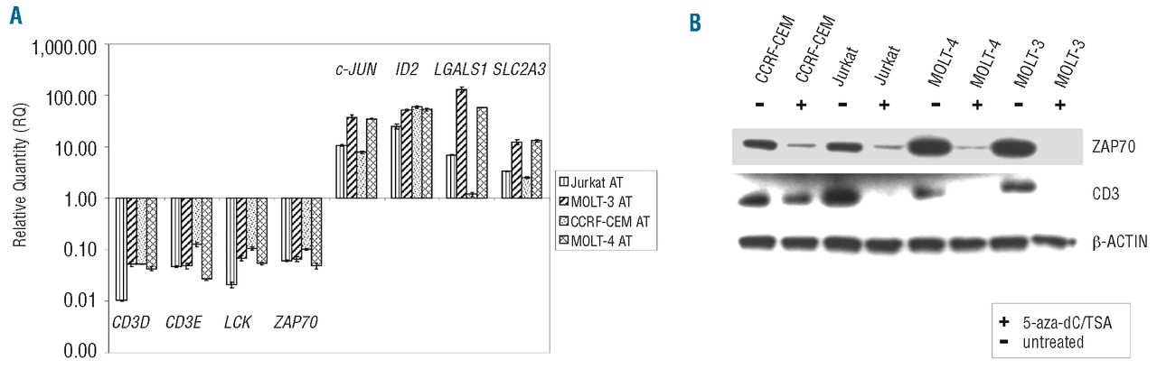 acetylation and DNA demethylation T result in an large cell lymphoma-like phenotype | Haematologica