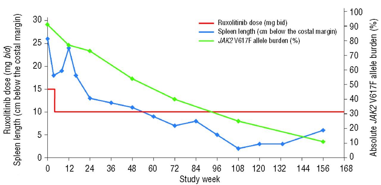 Resolution of bone marrow fibrosis in a patient receiving JAK1/JAK2