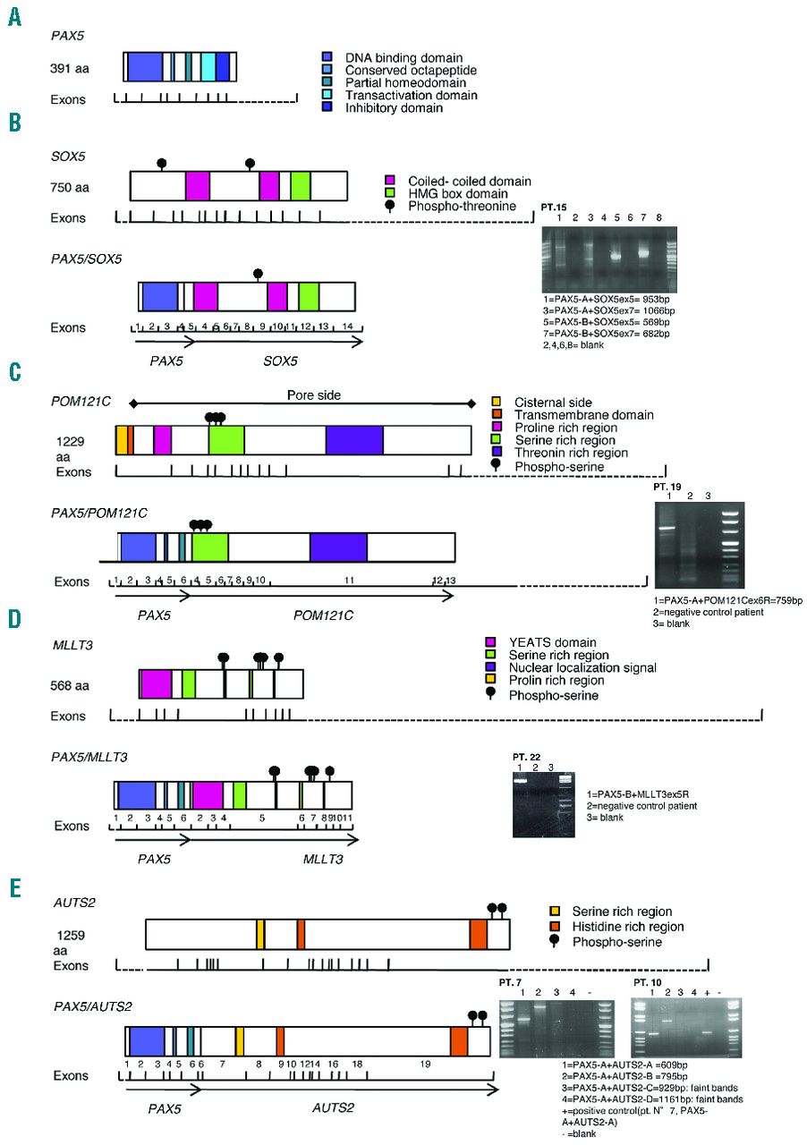 Three novel fusion transcripts of the paired box 5 gene in B-cell