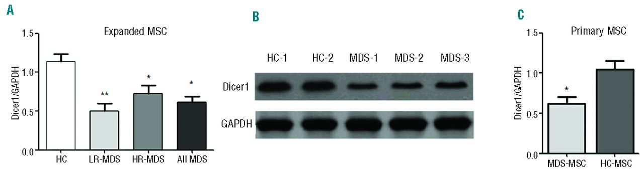 Down Regulation Of Dicer1 Promotes Cellular Senescence And Decreases The Differentiation And Stem Cell Supporting Capacities Of Mesenchymal Stromal Cells In Patients With Myelodysplastic Syndrome Haematologica