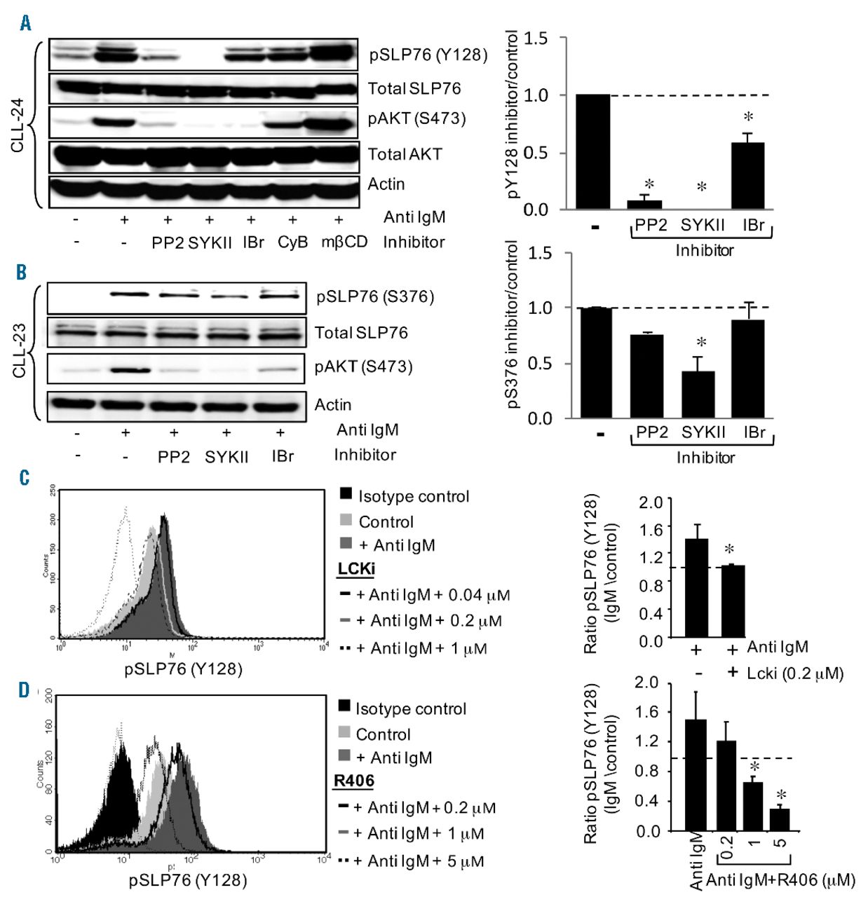 SLP76 integrates into the B-cell receptor signaling cascade in chronic