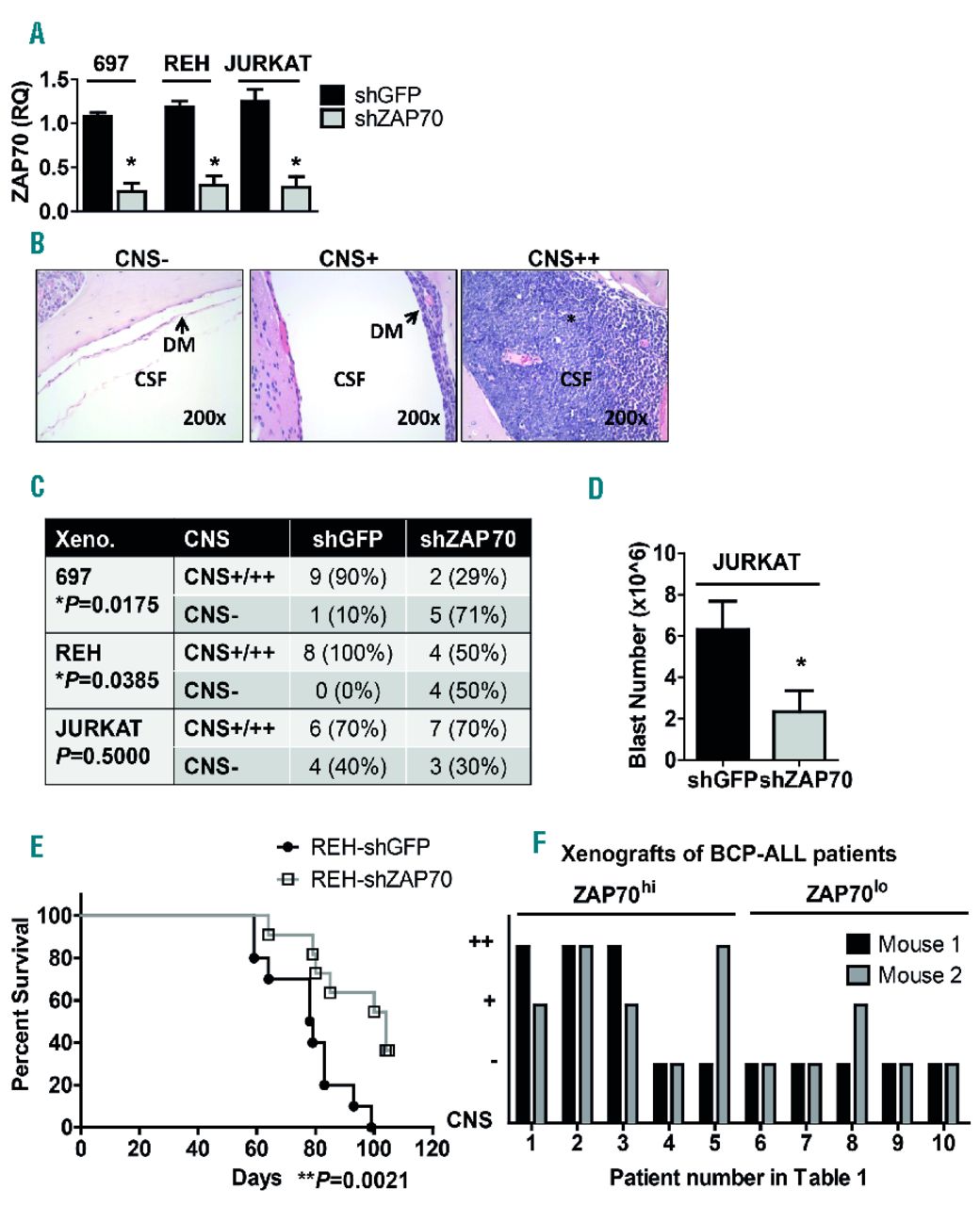 The Role Of Zap70 Kinase In Acute Lymphoblastic Leukemia Infiltration Into The Central Nervous System Haematologica