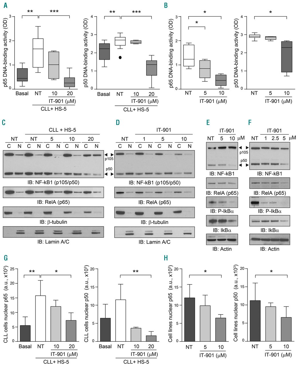 Religieus terug Snoep Targeting metabolism and survival in chronic lymphocytic leukemia and  Richter syndrome cells by a novel NF-κB inhibitor | Haematologica