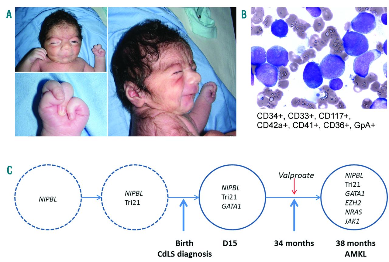 Frontiers  BETting on a Transcriptional Deficit as the Main Cause for  Cornelia de Lange Syndrome