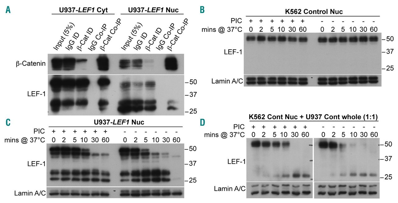 LEF 1 Drives Aberrant catenin Nuclear Localization In Myeloid 