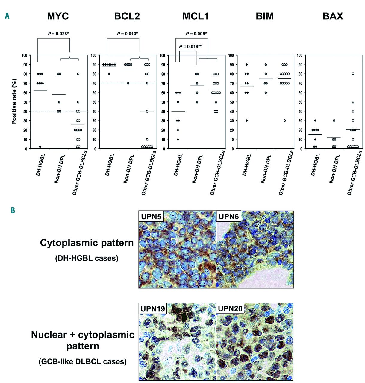 Targeting Bcl2 With Venetoclax Is A Promising Therapeutic Strategy For Double Proteinexpression Lymphoma With Myc And Bcl2 Rearrangements Haematologica