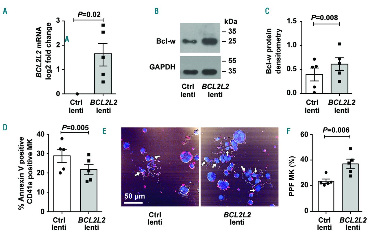 Anti Apoptotic l2l2 Increases Megakaryocyte Proplatelet Formation In Cultures Of Human Cord Blood Haematologica