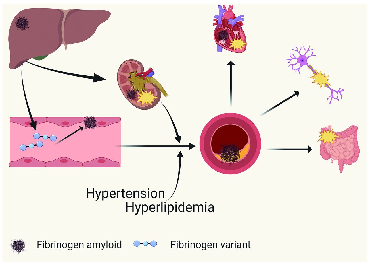 PDF] Searching for differences between fibrinogen and fibrin that affect  the initiation of fibrinolysis.