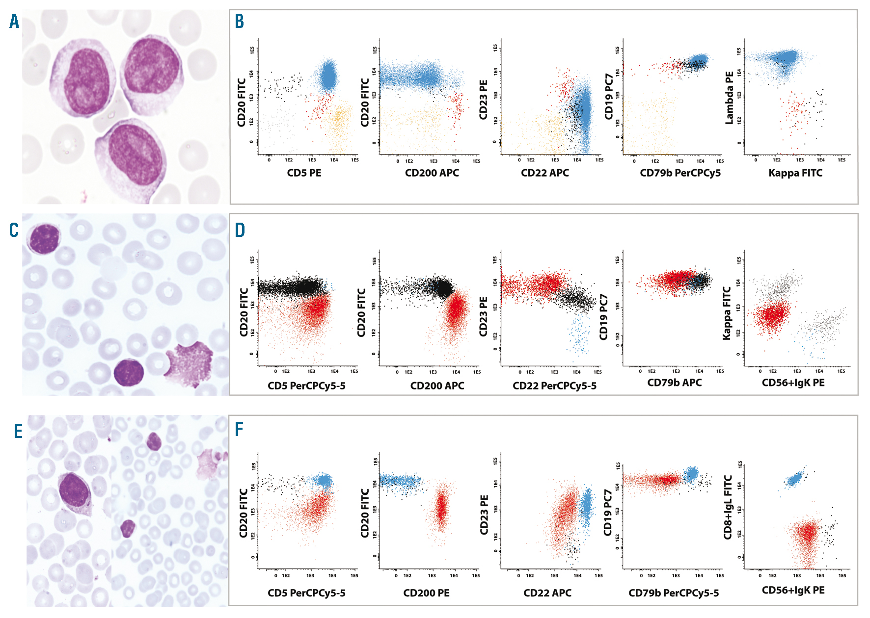 Flow Cytometry Test For Leukemia I Got Big Webcast Stills Gallery