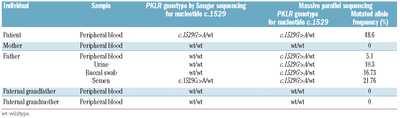 Jaundice  Pyruvate Kinase Deficiency