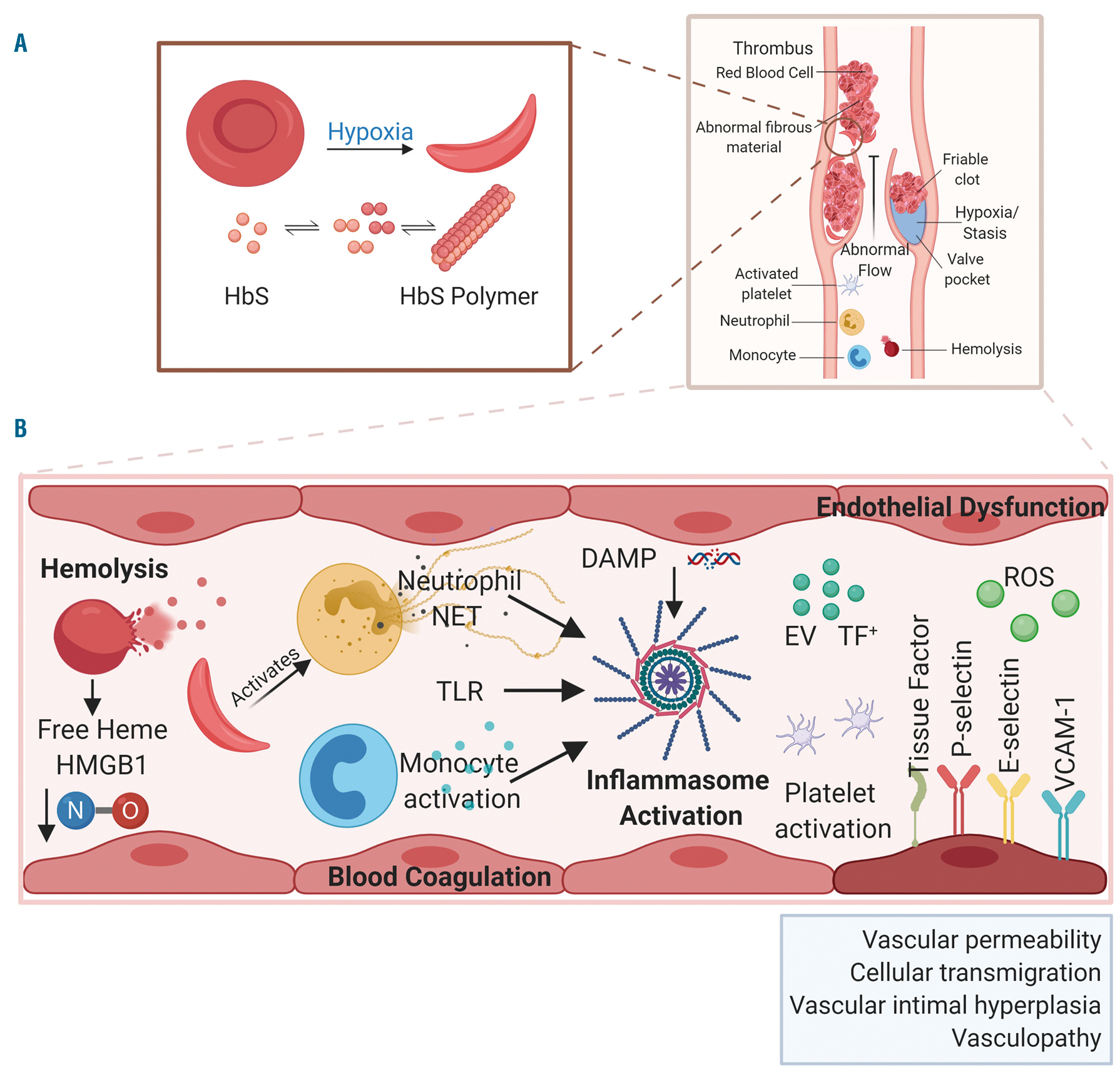 Laboratory Evaluation of Sickle Cell Disease in the ED — Taming the SRU