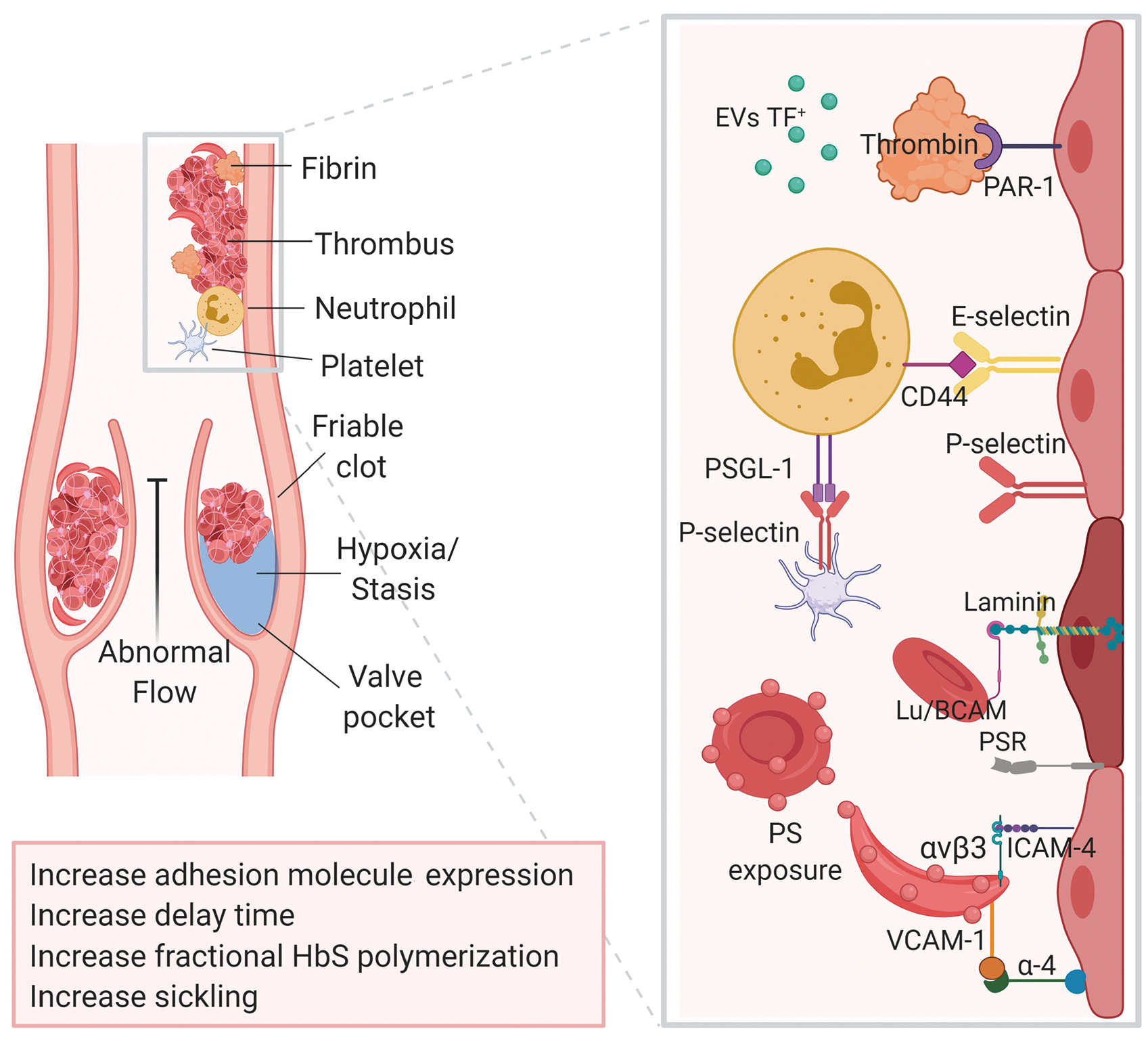 The Molecular Basis For The Prothrombotic State In Sickle Cell Disease Haematologica