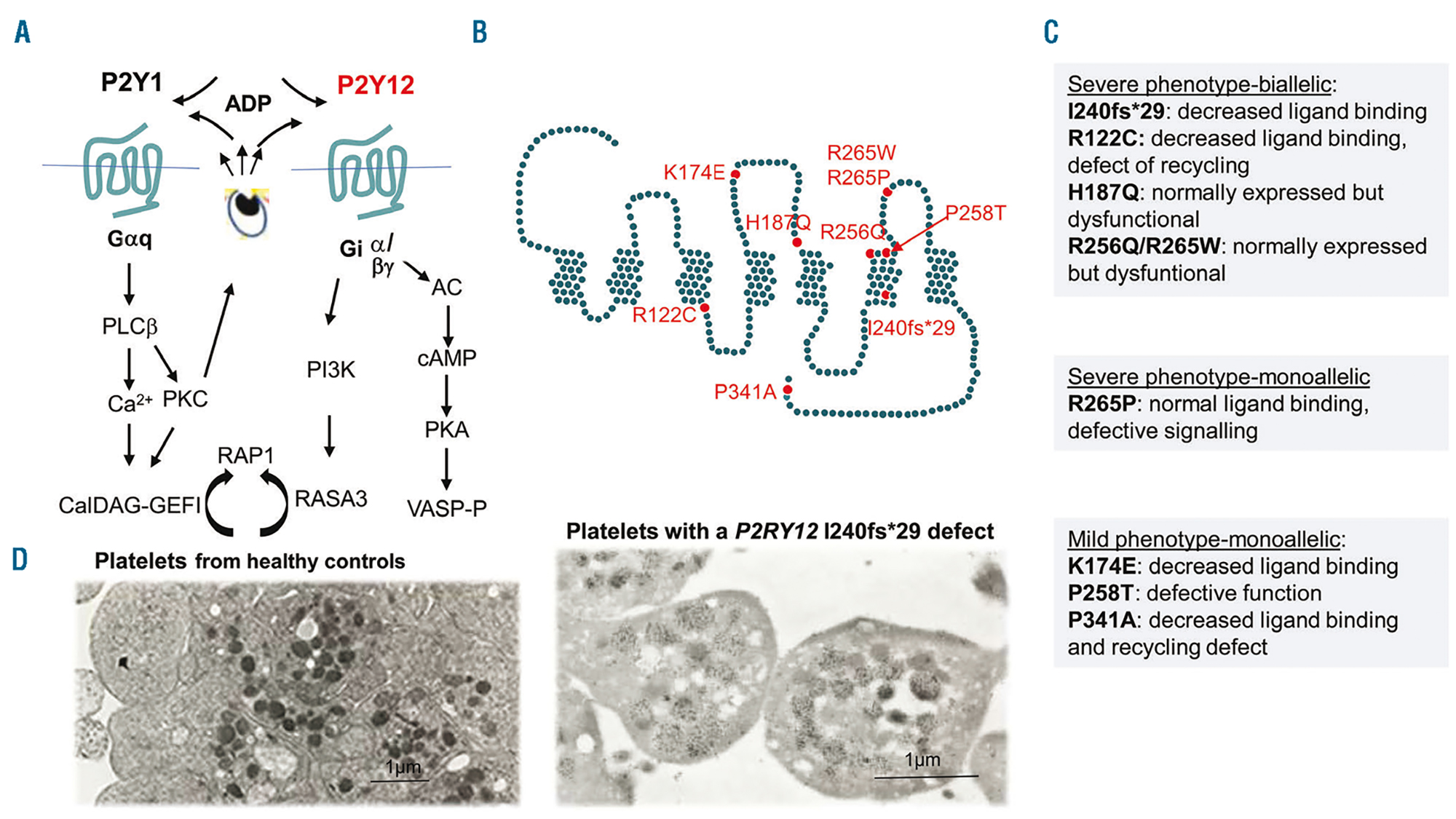 Inherited platelet diseases with normal platelet count: phenotypes,  genotypes and diagnostic strategy