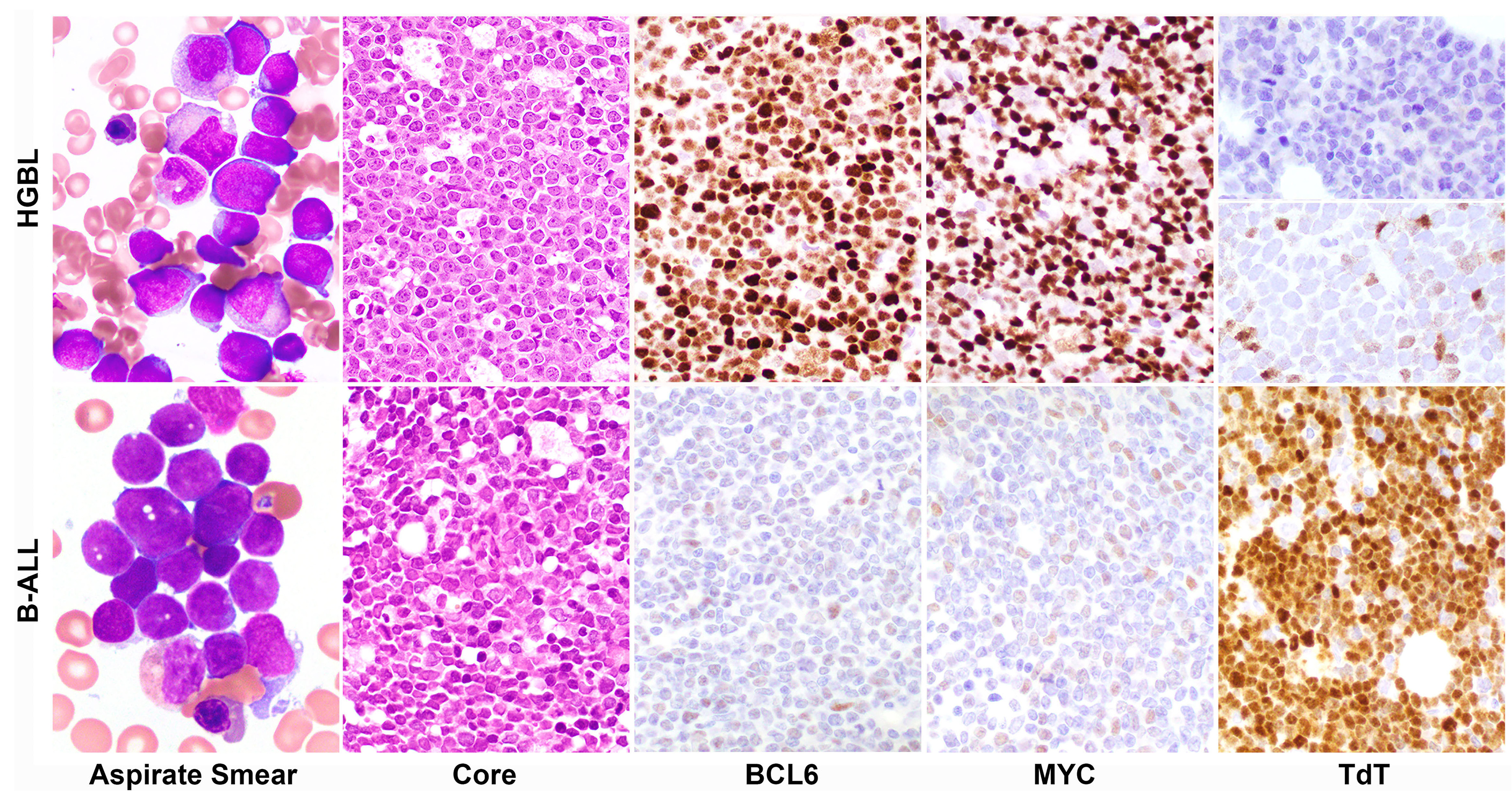 lymphoblast cell